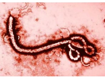 San Marino Oggi. Virus Ebola, Authority sanitaria e Iss: ‘Tutto sotto controllo’
