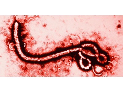 San Marino. Ebola, Upr interpella il Governo: ‘Quali misure di prevenzione e monitoraggio sono state prese’?