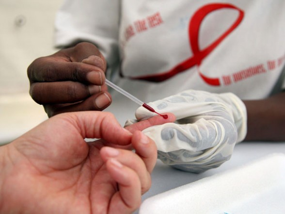 Rimini. Giornata mondiale contro l’AIDS: l’1 e 2 dicembre sarà possibile fare il test per l’Hiv in modo semplice, anonimo e gratuito