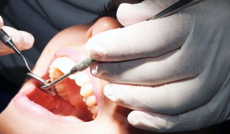 Rimini. Muore sulla poltrona del dentista dopo un intervento di routine